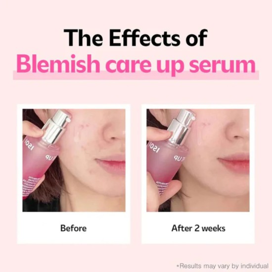 ISOI - Blemish Care Up Serum 25ml