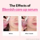 ISOI - Blemish Care Up Serum 25ml