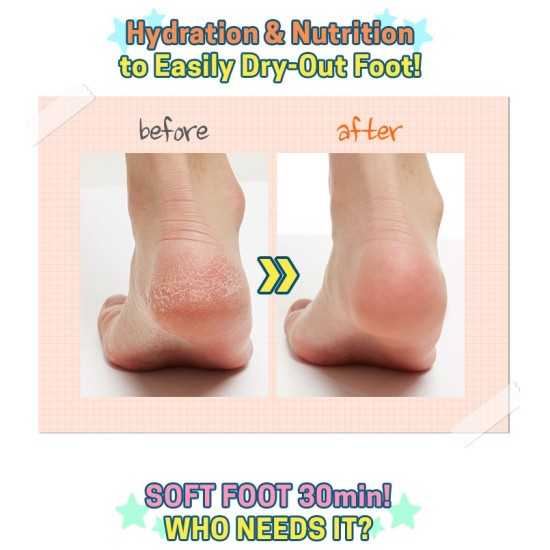 Apieu - Soft Foot 30 Minute Peeling Socks 8806185788311 www.tsmpk.com